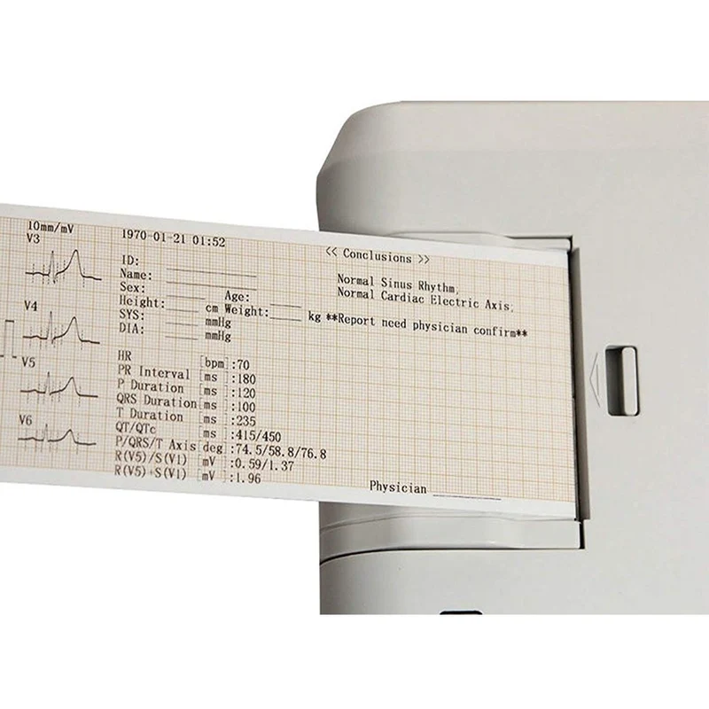 Elektrokardiograph ECG300G 3 Kanal EKG | LCD Bildschirm | Drucksystem | MB300G | Mobiclinic